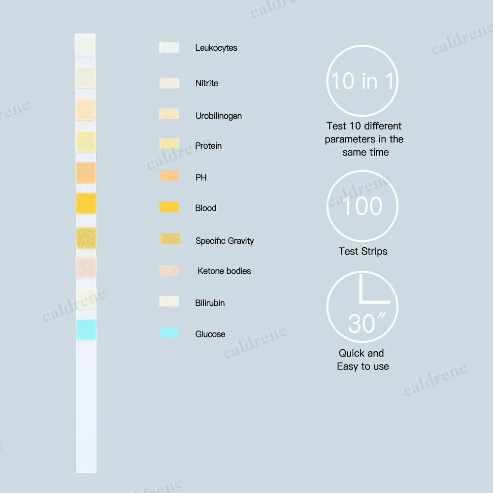 100X Test Strips Urine Tester Reagent Urinalysis URS-10T 10 Parameter Test Strip – view 3