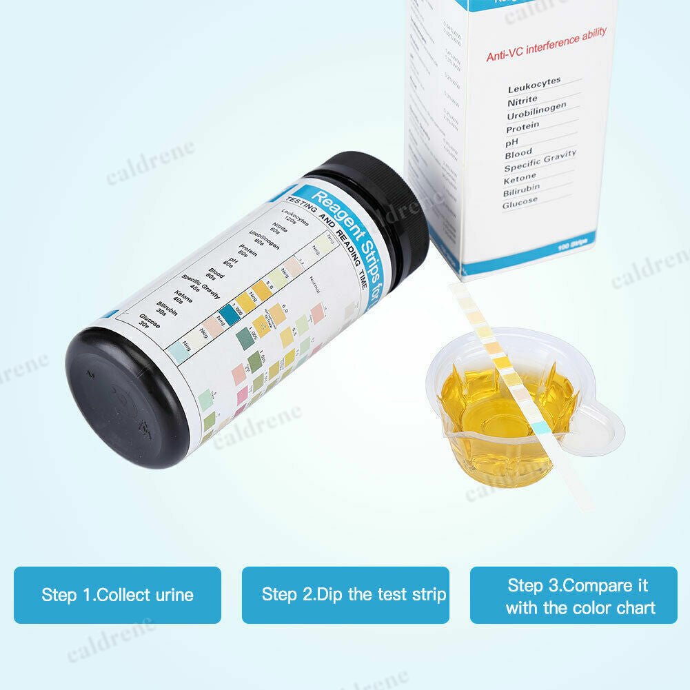 100X Test Strips Urine Tester Reagent Urinalysis URS-10T 10 Parameter Test Strip – view 4