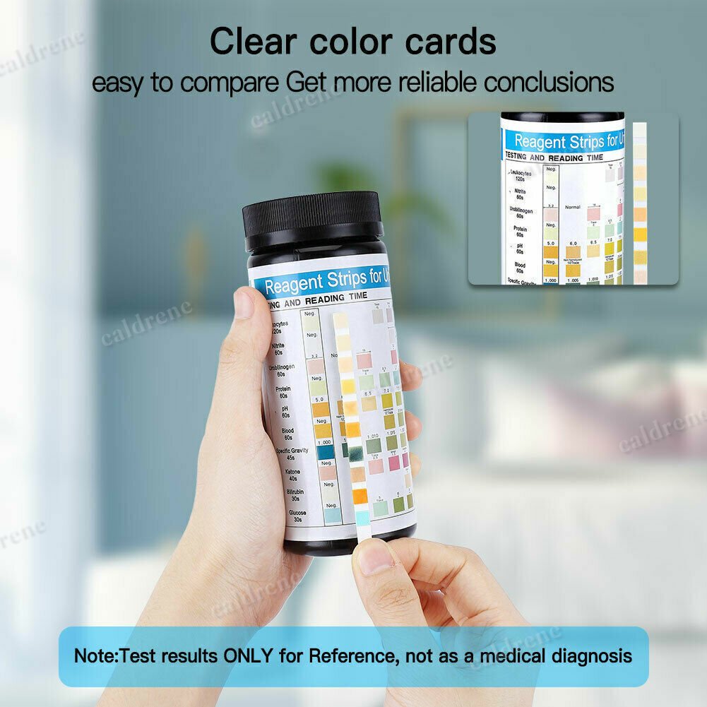 100X Test Strips Urine Tester Reagent Urinalysis URS-10T 10 Parameter Test Strip – view 5