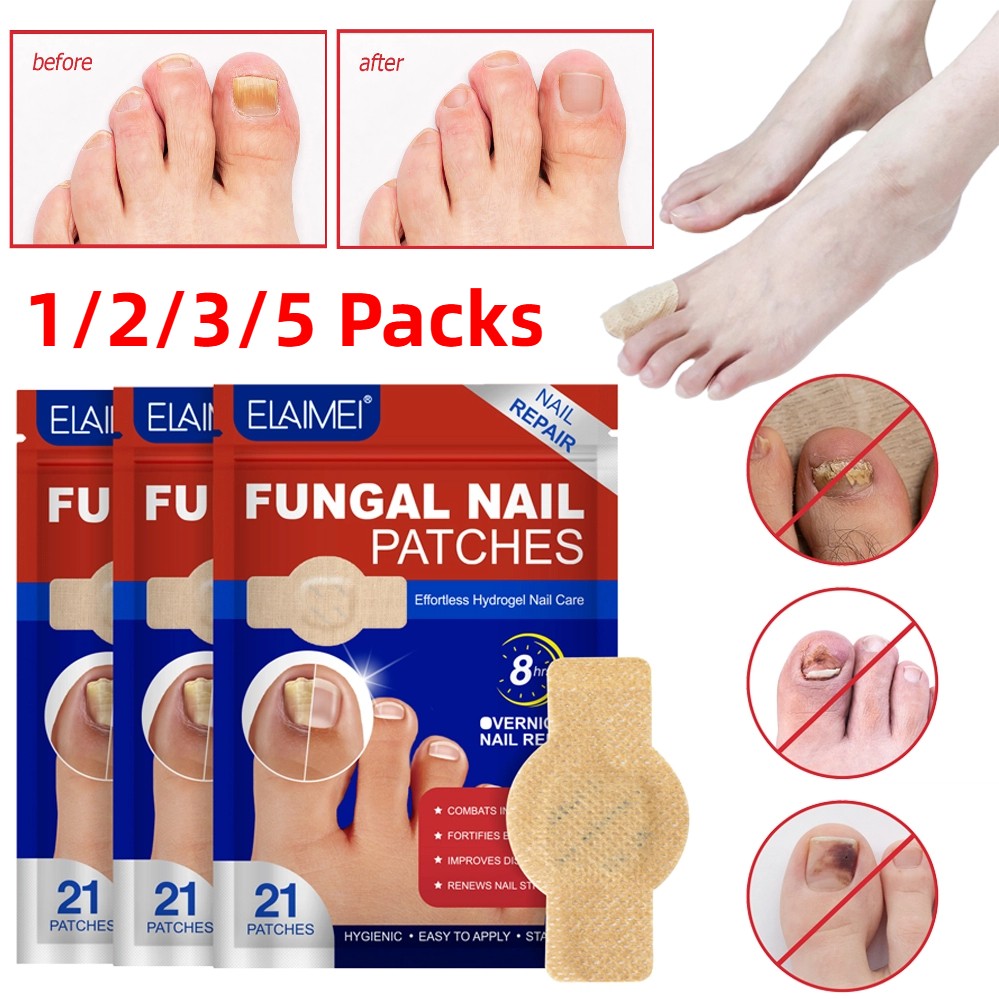 21-105PCS Toenail Antiseptic Patch Long Lasting Breathable Fungal Nail Patches