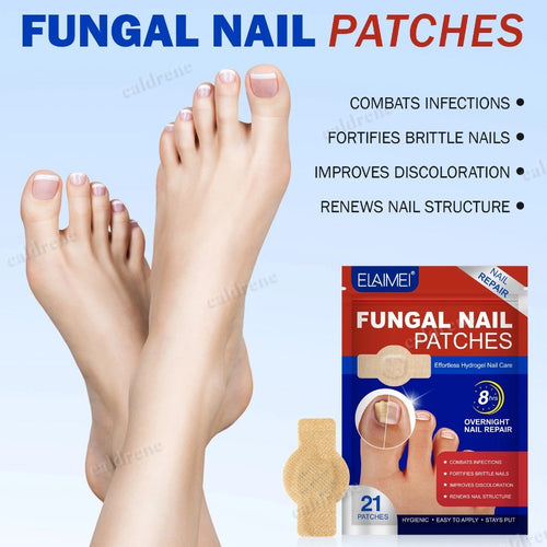 21-105PCS Toenail Antiseptic Patch Long Lasting Breathable Fungal Nail Patches – view 2