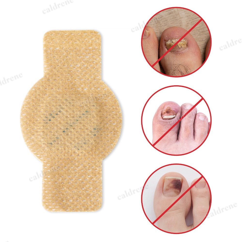 21-105PCS Toenail Antiseptic Patch Long Lasting Breathable Fungal Nail Patches – view 7