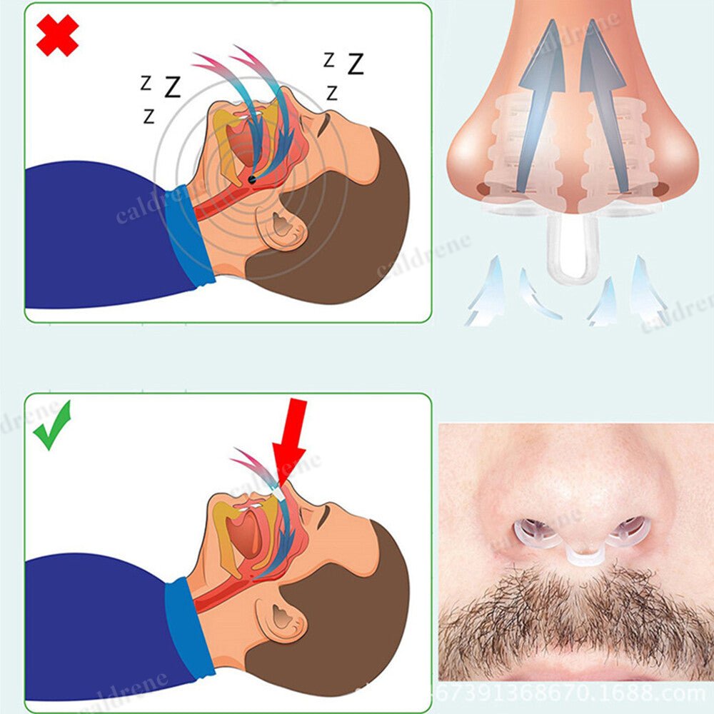 5-100PCS Anti Snore Nasal Dilators Stop Snoring Nose Clip Sleep Apnea Aid Device – view 5