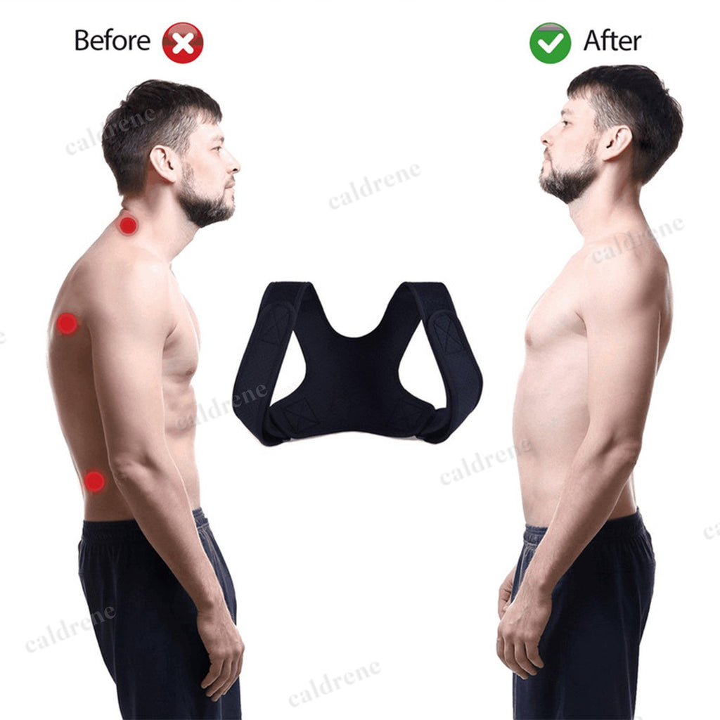 Adjustable Posture Corrector – view 2