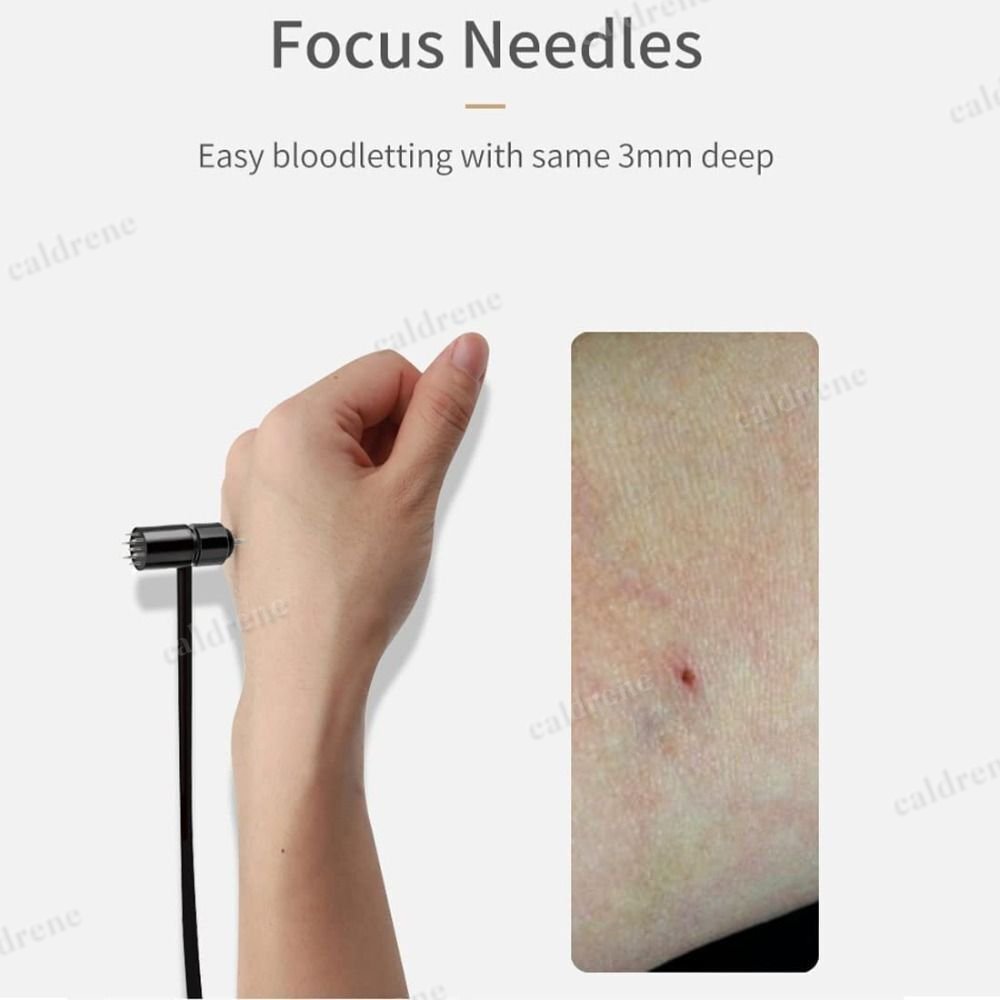 Dermal Hammer 7 Star Needle 7 Star Plum Blossom Hammer for Beauty for Home Use – view 5