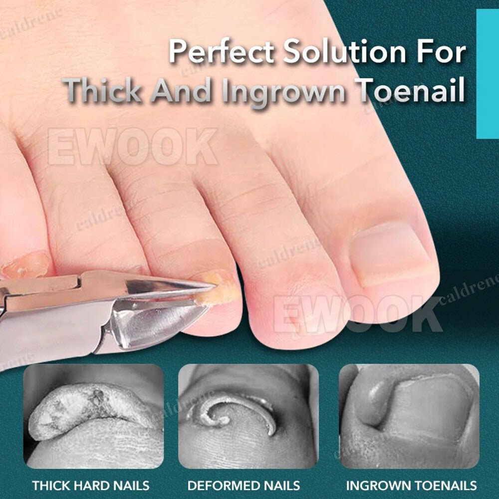 Heavy Duty Large Toe Nail Clippers for Thick Nails – view 7