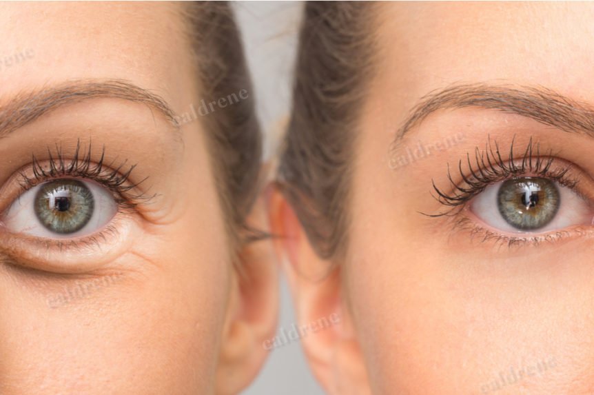 Hyaluronic Acid and Vitamin C Under Eye Serum – view 2