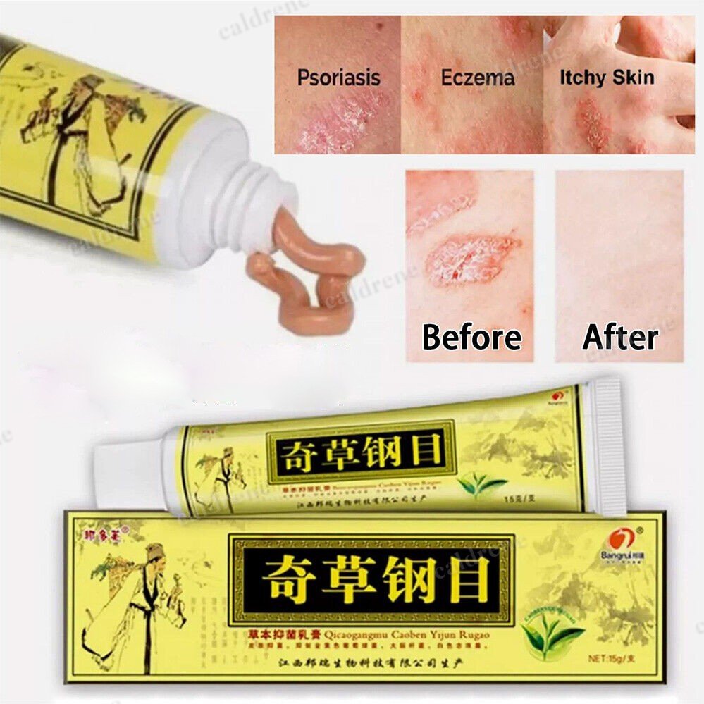Natural Chinese Herbal Skin Cream Moisturising Ointment Healing Cream Skin Care – view 2