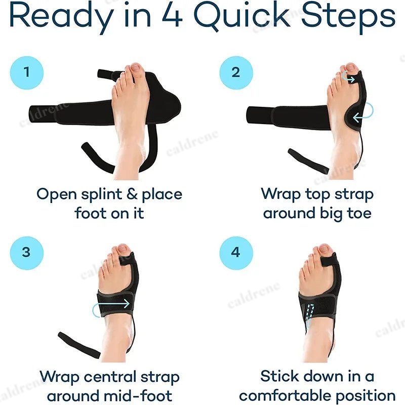 Orthopedic Bunion Splint Corrector Big Toe Separator Pain Relief Non-Surgical Ha – view 7