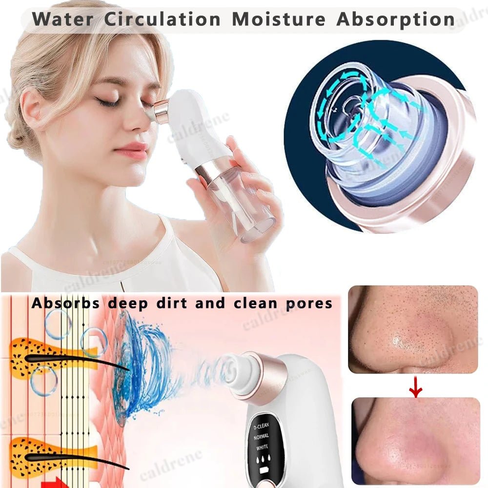 Pore Vacuum Cleaner for Gentle Blackhead Removal – view 3