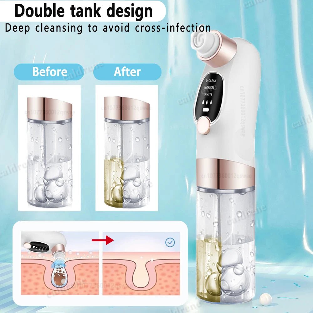 Pore Vacuum Cleaner for Gentle Blackhead Removal – view 4