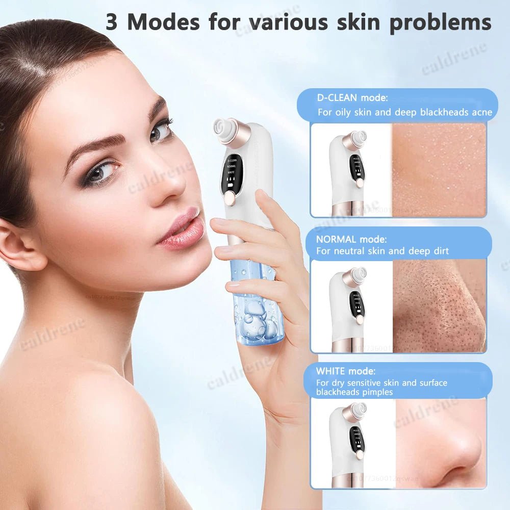 Pore Vacuum Cleaner for Gentle Blackhead Removal – view 6