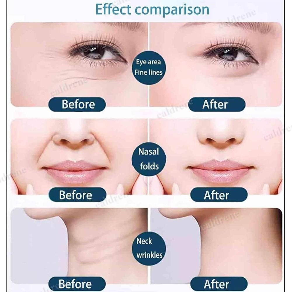 Toning Japanese Face Tape for Instant Skin Tightening – view 4