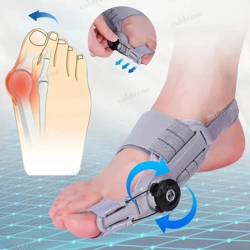 Treatmedy Bunion Fix Big Toe Straightener Adjustable Bunion Corrector – view 2