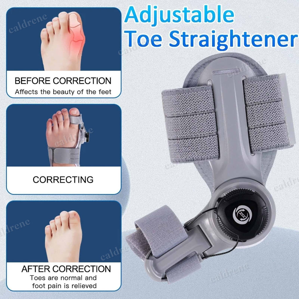 Treatmedy Bunion Fix Big Toe Straightener Adjustable Bunion Corrector – view 3