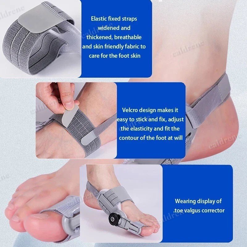 Treatmedy Bunion Fix Big Toe Straightener Adjustable Bunion Corrector – view 5