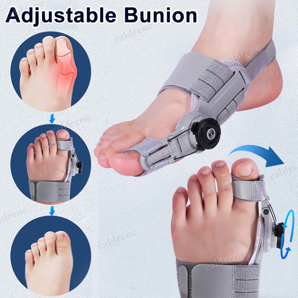 Treatmedy Bunion Fix Big Toe Straightener Adjustable Bunion Corrector – view 7