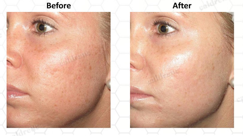 Vitamin C 30% Facial Serum with Hyaluronic and Ferulic Acid – view 2