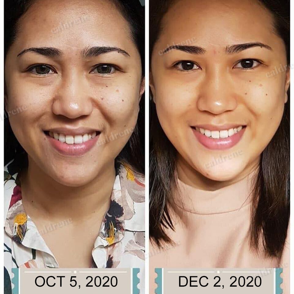 Vitamin C 30% Facial Serum with Hyaluronic and Ferulic Acid – view 5