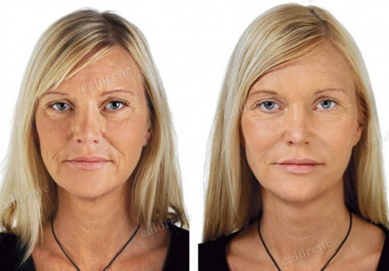 Vitamin C 30% Facial Serum with Hyaluronic and Ferulic Acid – view 7